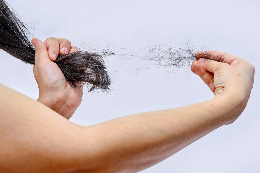 A Cure For The Age Old Problem Of Hair Loss