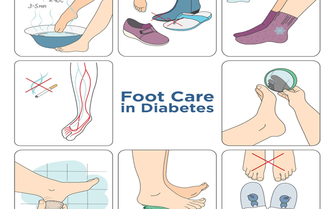 7 Diabetes Foot Care Tips